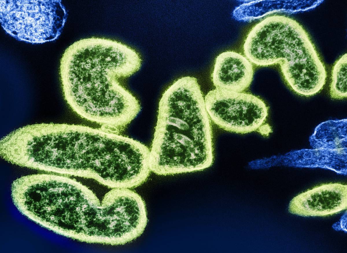 digestive health gut nutrition zonulin: The Hidden Link Most Doctors Miss